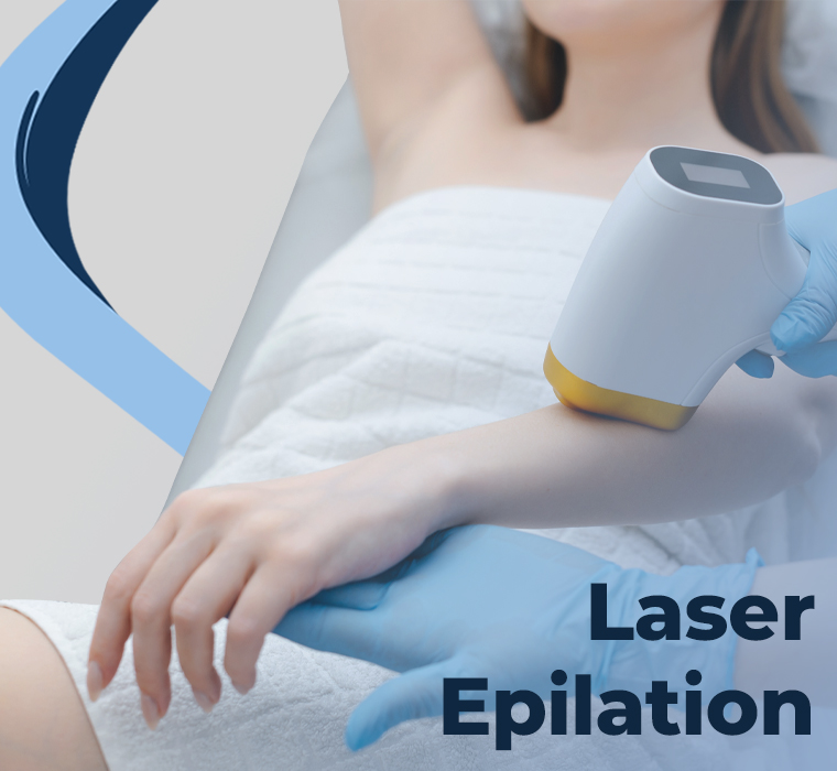 Laser Epilation